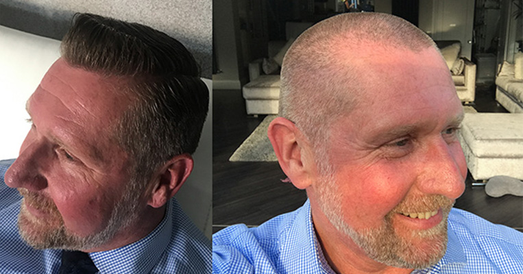 Michael Dray hair, before and after